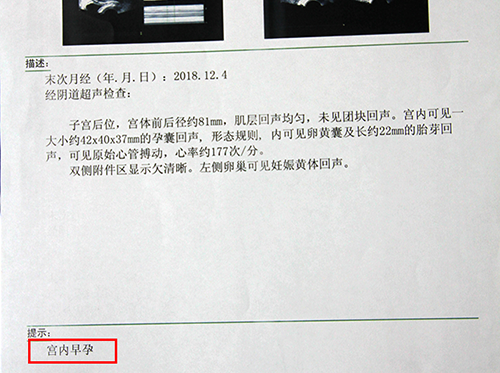 成都治疗不孕的专长医院